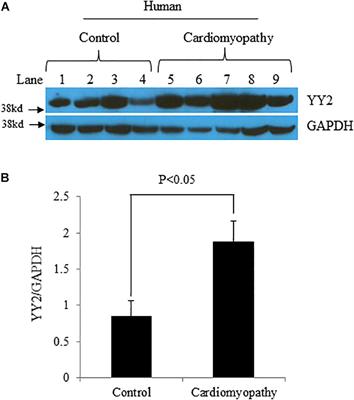 Contribution of Increased Expression of Yin Yang 2 to Development of Cardiomyopathy